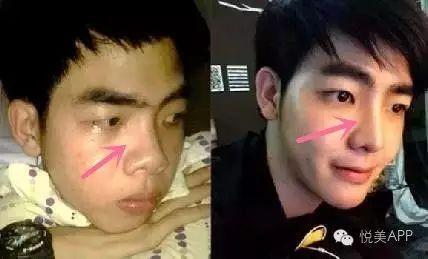 男网红整容脸吃瓜视频,吃瓜群众热议的整形真相 第2张 男网红整容脸吃瓜视频,吃瓜群众热议的整形真相 第2张